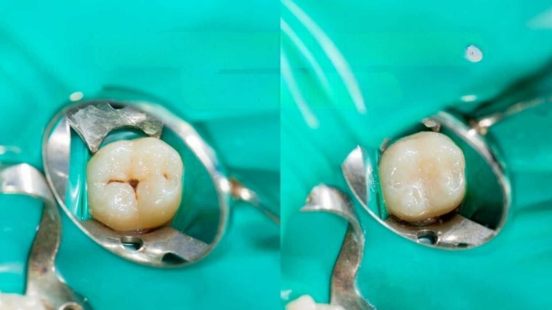 The Wool Wire | September 11, 2025